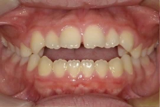 Before image