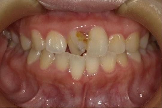 Before image