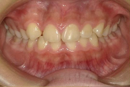Before image