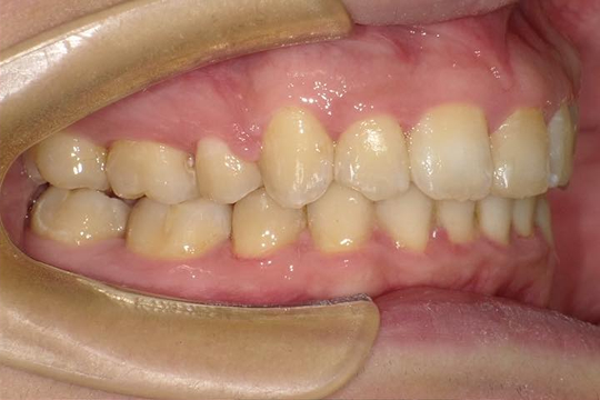After image