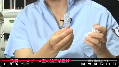 矯正装置について