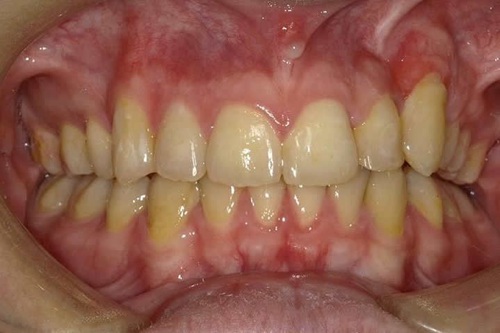 After image