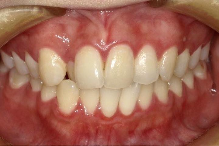 Before image